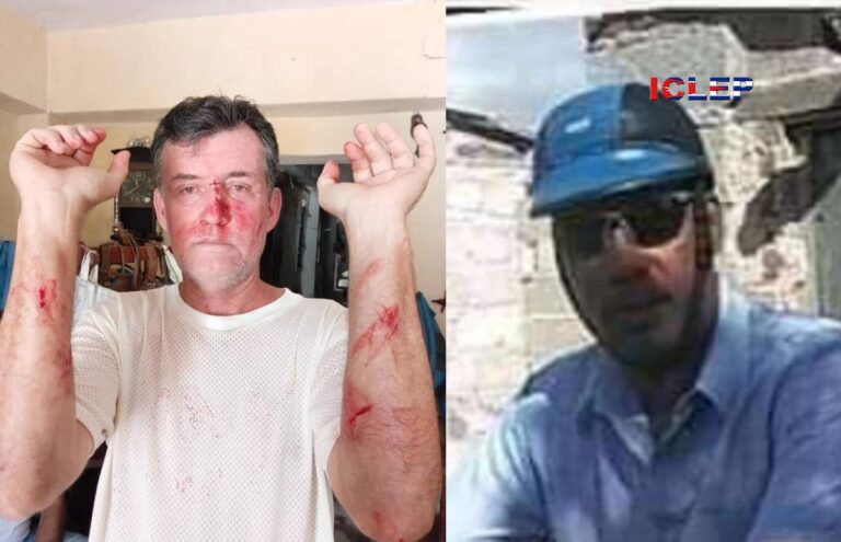 Paramilitares golpean a periodista Adriano Castañeda por órdenes de la Policía Política