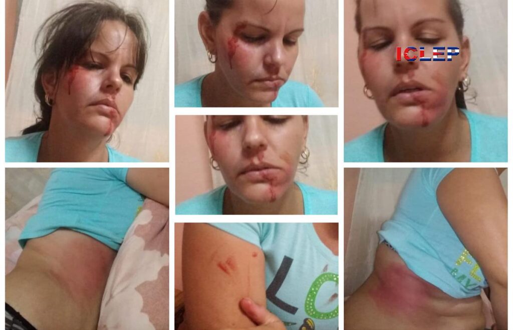 Periodista del ICLEP es golpeada por dos encapuchados
