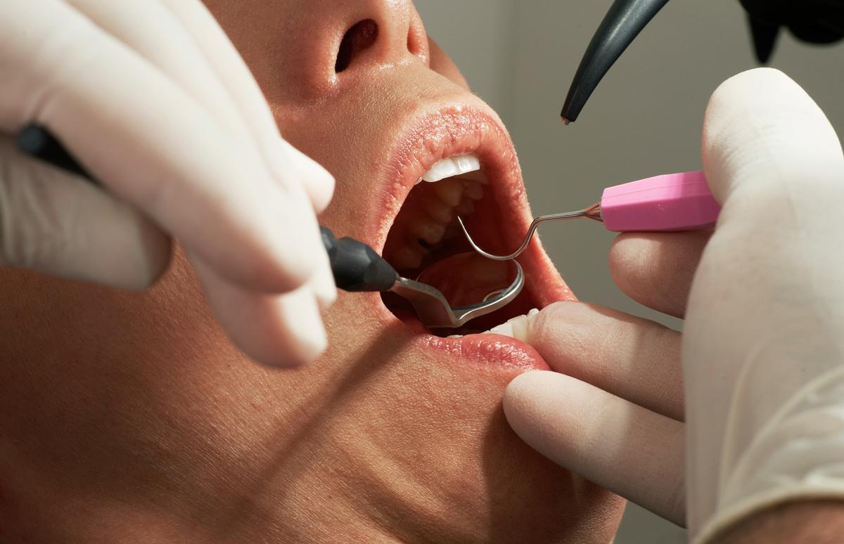 De prohibido a necesario el suministro de material dental