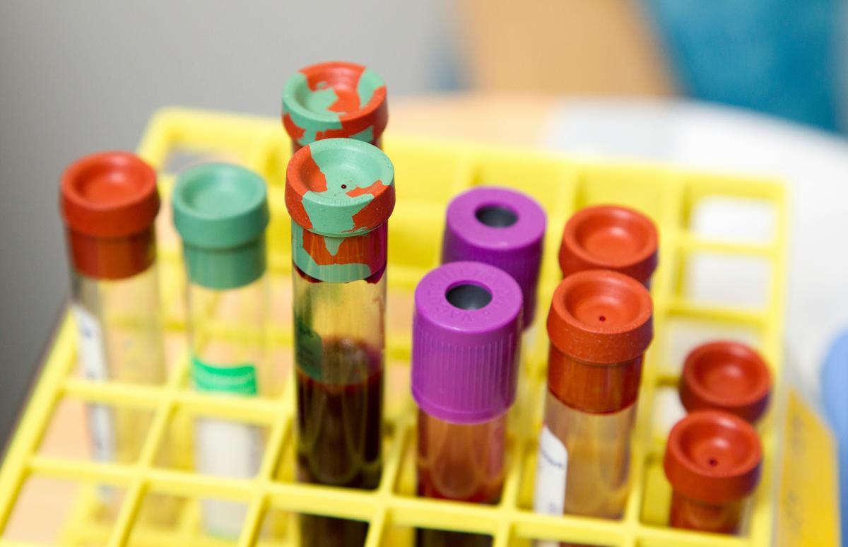Sin reactivos para realizar análisis en laboratorios médicos