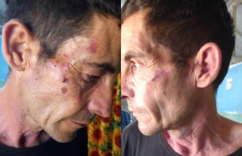 Golpeado y esposado a una silla: Expreso político denuncia brutalidad policial en Villa Clara