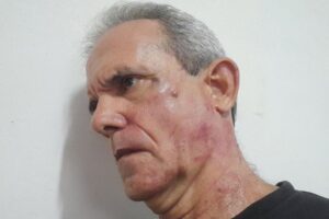 Jorge Fernández It was with obvious signs of physical aggression. Photo taken from his Facebook profile.
