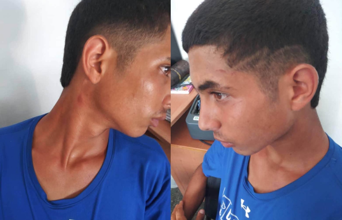 Detienen y golpean a menor de edad Alex Javier Hernández González tras protesta en Santiago de las Vegas