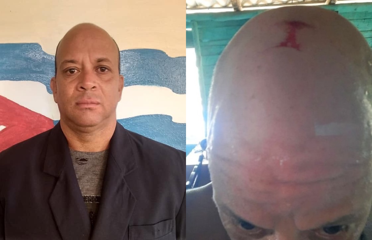 Golpean y amenazan a periodista independiente José Antonio López Piña en Santiago de Cuba